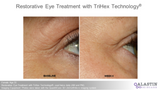 Restorative Eye Treatment