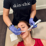 Series of 3 | Regenerative Microneedling | Save $100
