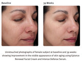 Epionce Renewal Facial Cream