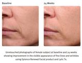 Epionce Renewal Facial Cream